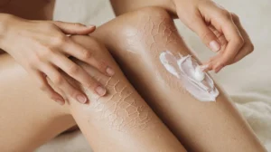 Effective dry skin remedies for hands and legs, showing hydration and relief.